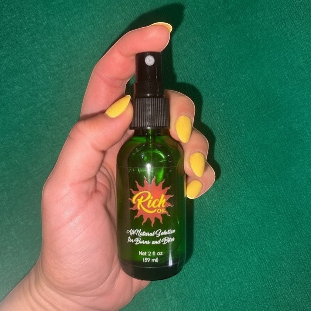 The Rich Oil spray bottle, a green glass bottle with a black spray top, held by a hand with yellow nail polish. The label reads 'Rich Oil All Natural Solution for Burns and Bites'.